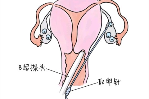 http://dongguan.vdtfzz.com/post/205.html|东莞供卵助孕
