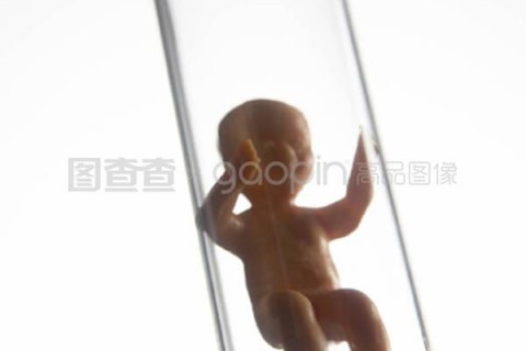 http://dongguan.vdtfzz.com/post/197.html|东莞试管助孕